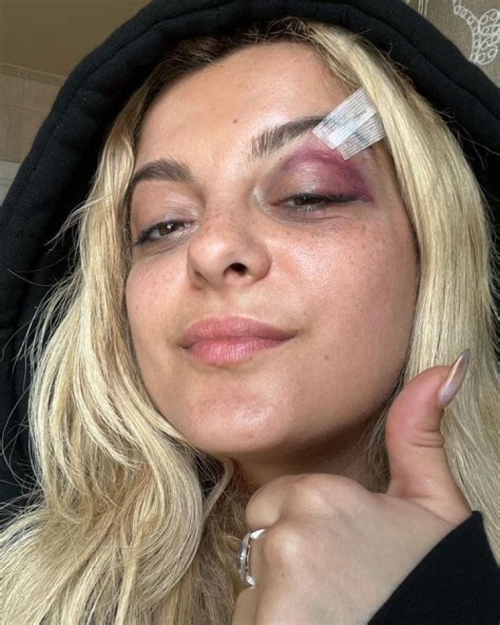 Bebe Rexha Proudly Shows Off Her Stretch Marks In Unfiltered TikTok: ‘I’m Tired Of Photoshop’