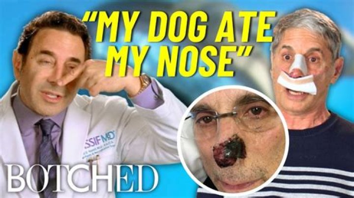 ‘Botched’ Preview: A Dog Bite Victim Comes To Dr. Nassif To Fix His Disfigured Nose — Watch
