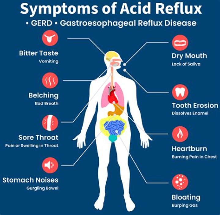 Can acid reflux give fever?