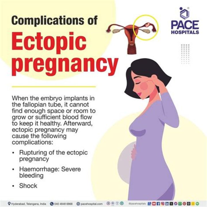 Can an ectopic pregnancy leave you infertile?