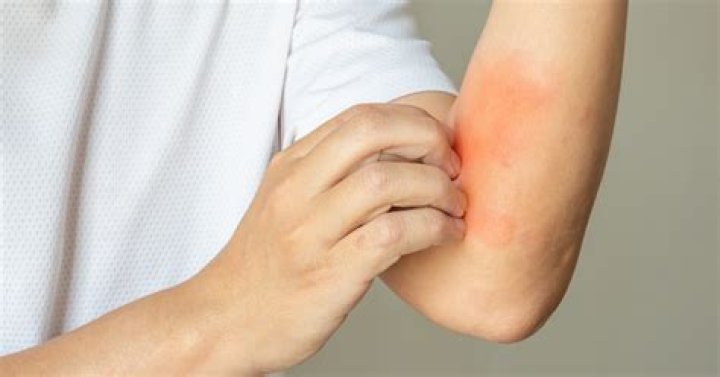 Can anemia cause diarrhea?