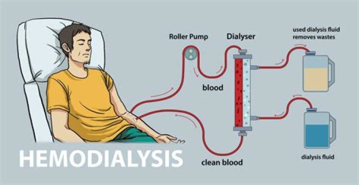 Can dialysis remove fluid from lungs?