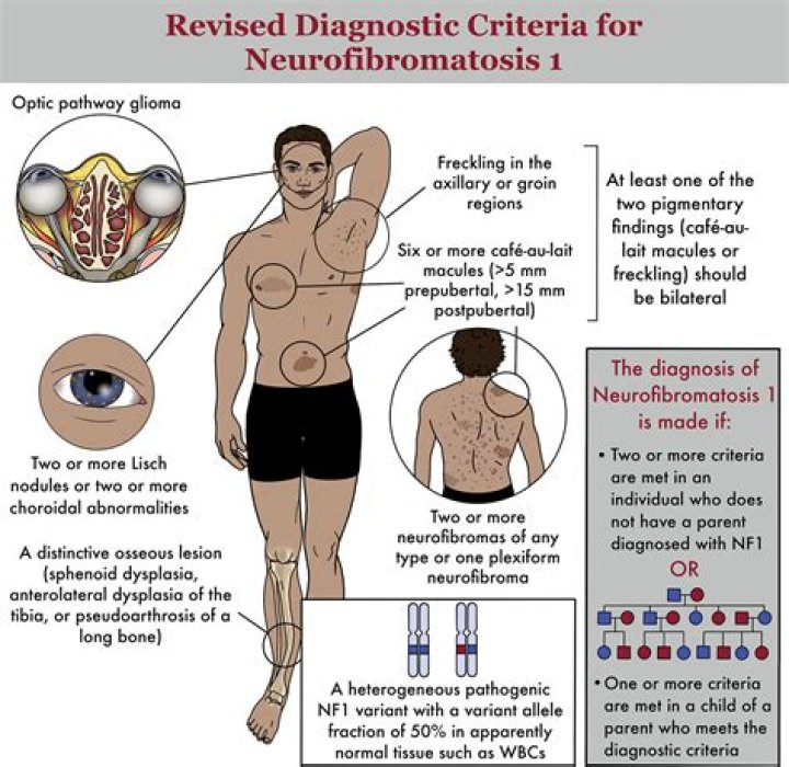 Can neurofibromatosis cause headaches?