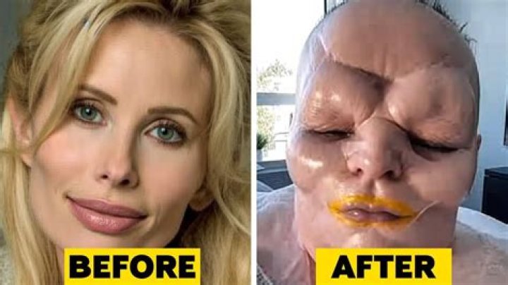 
Did Teresa Ruiz Ever Had A Plastic Surgery Done? Fans Wonder If Her Body Style Is Natural Or Transformed 
