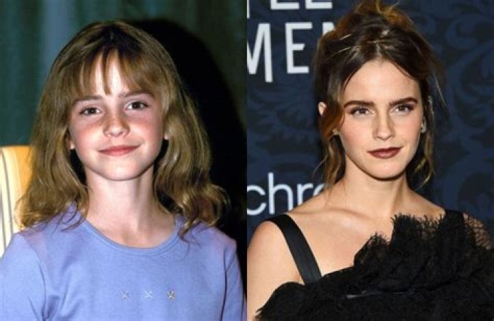 Emma Watson Through The Years: Photos – Hollywood Life