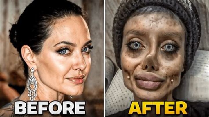 
Has Carol Vorderman Had Plastic Surgery Done On Her? Cosmetic Upgrades Matter Could Not Be Hidden 