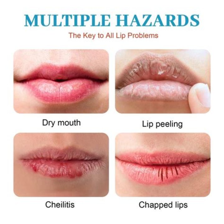 How can I soften my lips fast?