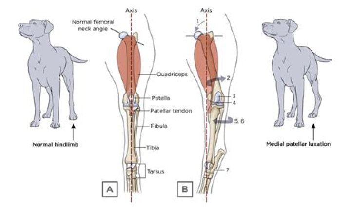 How do you fix a subluxation of ulnar nerve?