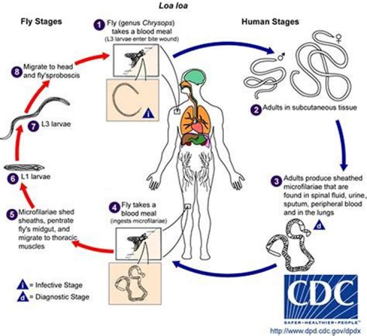 How do you get loiasis?
