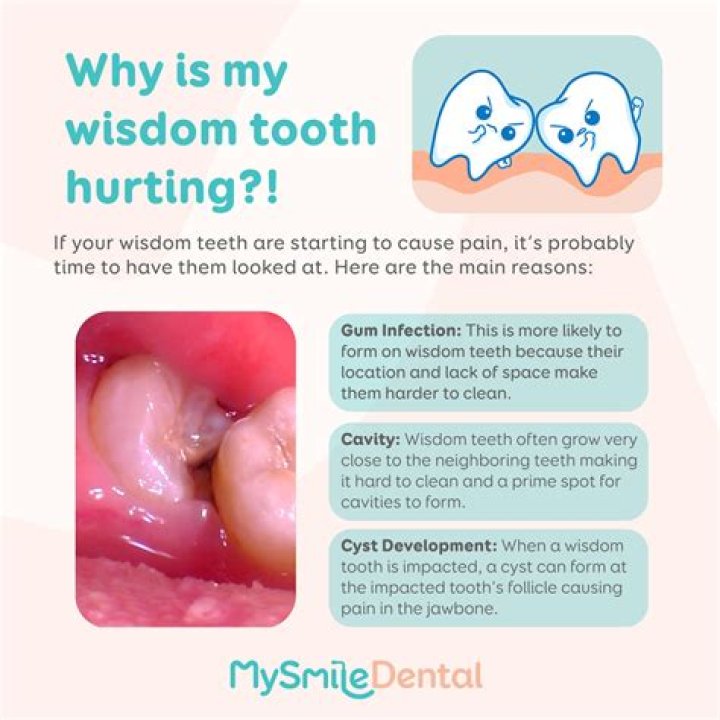 How long does it hurt when a wisdom tooth is coming in?