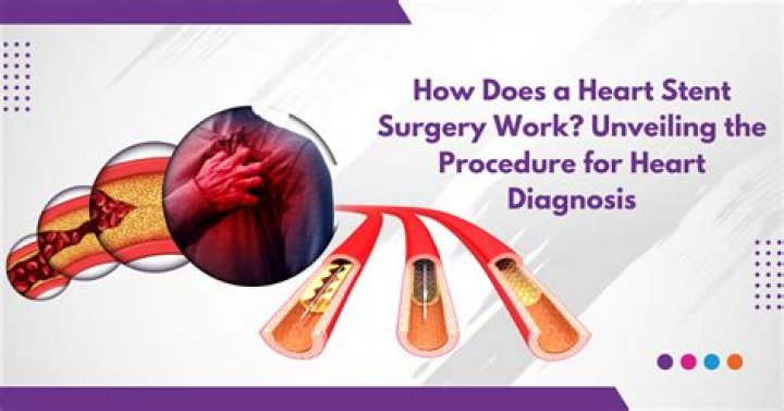 How long does it take to recover from a heart stent?