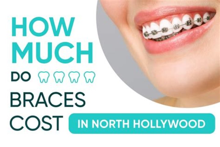 How much do teeth braces cost in California?