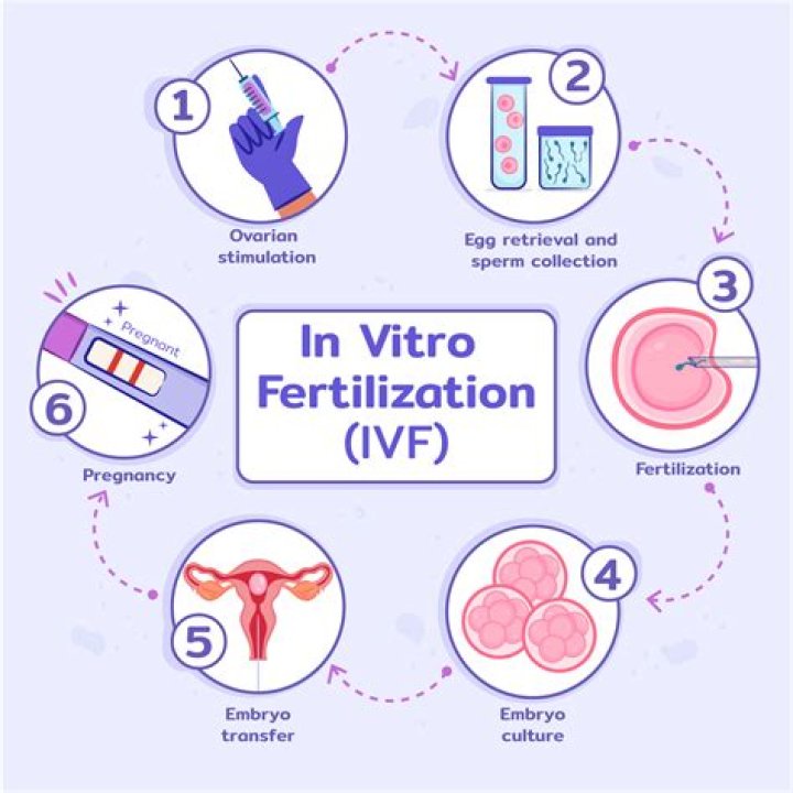 How much is IVF in Barcelona?
