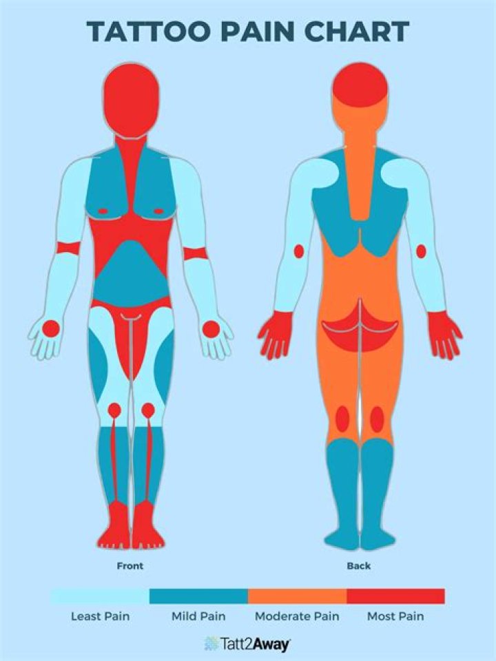 How painful is barrage laser?
