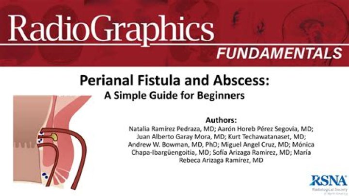 How serious is perianal fistula?