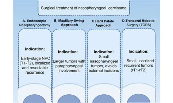 Is EBV associated with nasopharyngeal carcinoma?
