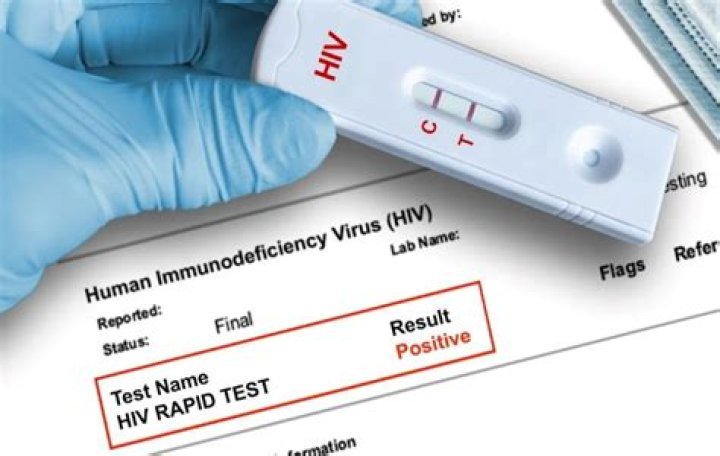 Is there a rapid HIV test?