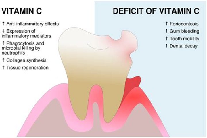Is vitamin C good for your teeth?
