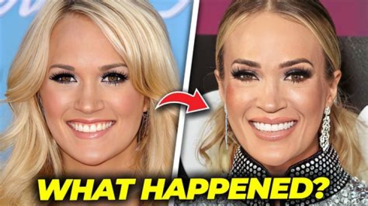 
Kendall Johnson Injury – What Happened To Her? 