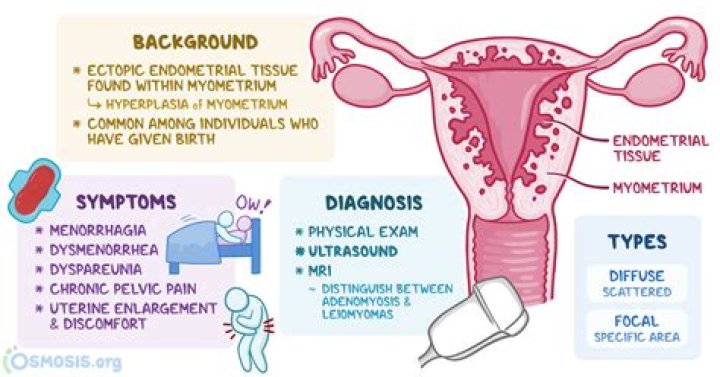 What causes a heterogeneous uterus?