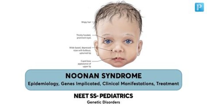 What chromosome is affected in Noonan syndrome?