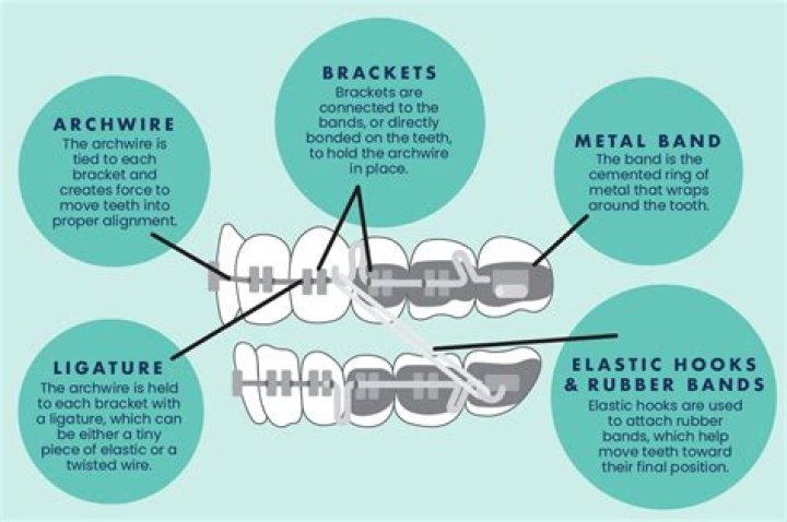 What does belt and braces approach mean?