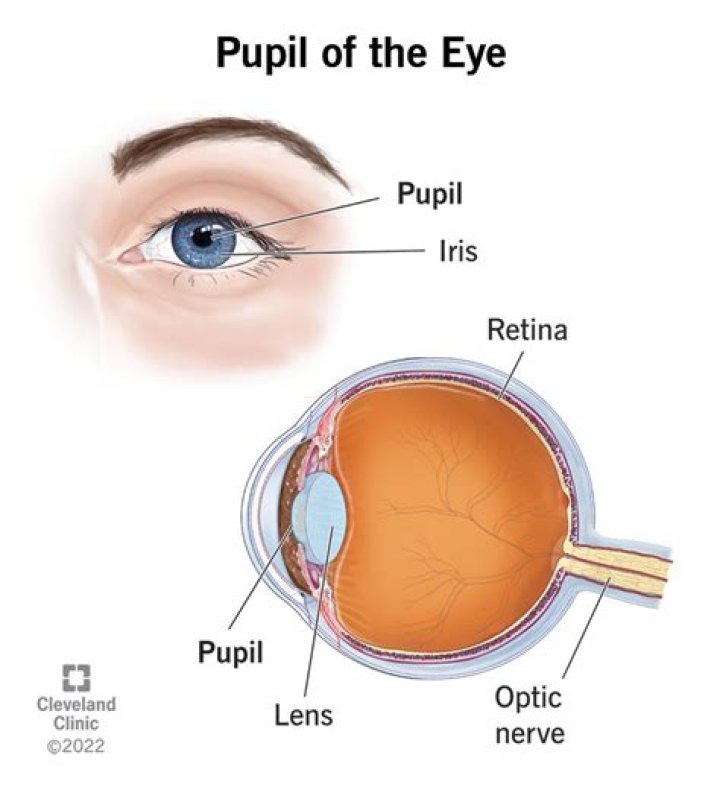 What does it mean when you have a GREY ring around your pupil?