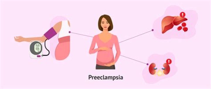 What does rib pain from preeclampsia feel like?