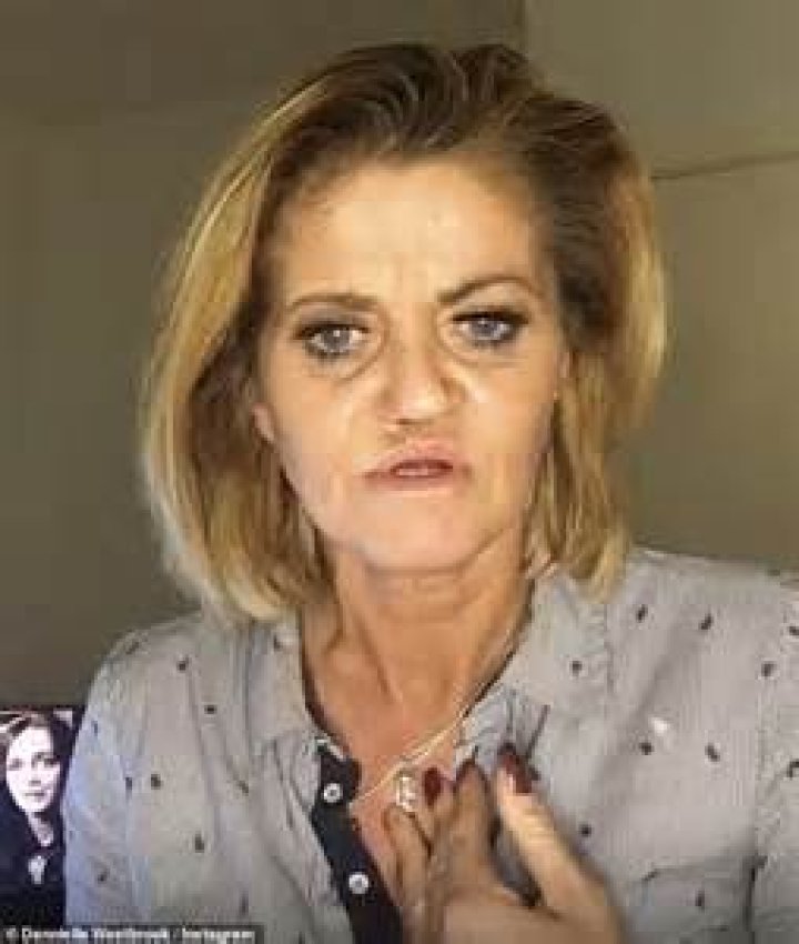 What Happened With Danniella Westbrook Face And Nose? Fans Are Curious About Her Peculiar Expressions