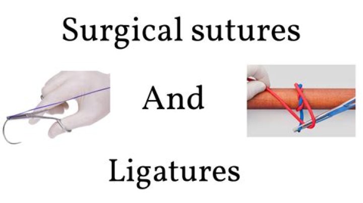 What is a ligature in surgery?