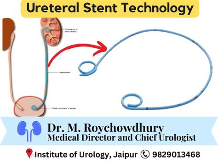 What is a stent implantation?