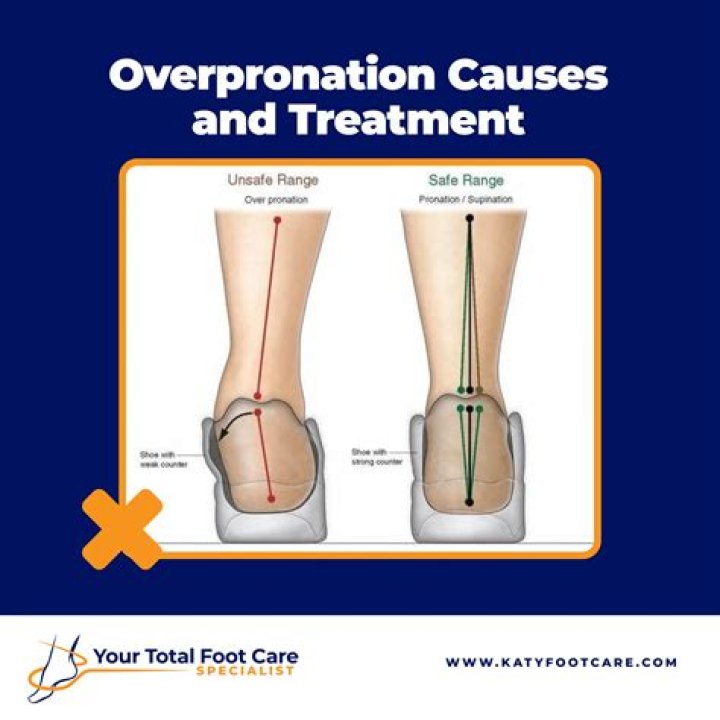 What is Asics pronation?