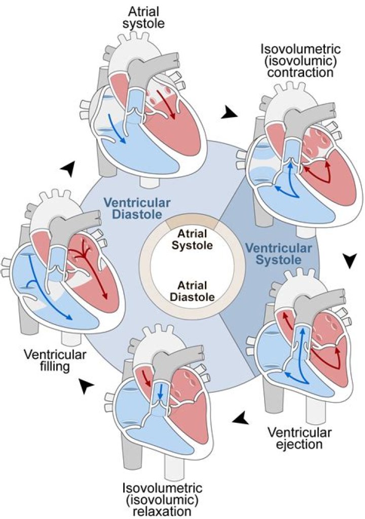 What is left ventricular Akinesis?