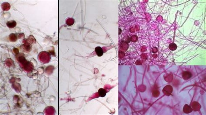 What is Saprophytic Neisseria?