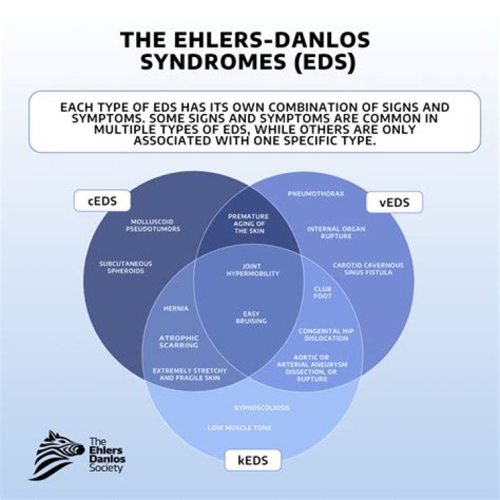 What type of Ehlers-Danlos is vascular?