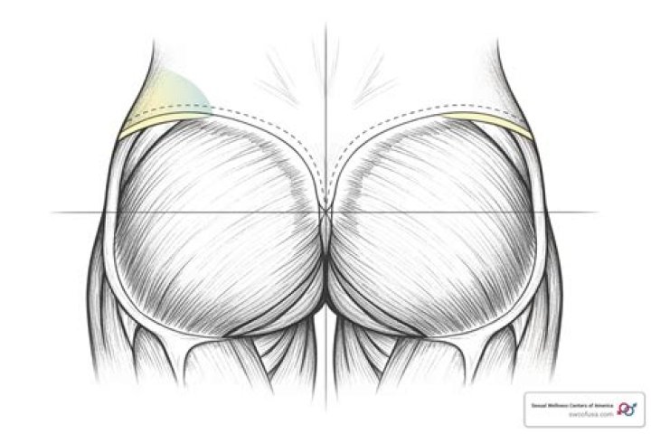 Where is the ventrogluteal site for im injections?
